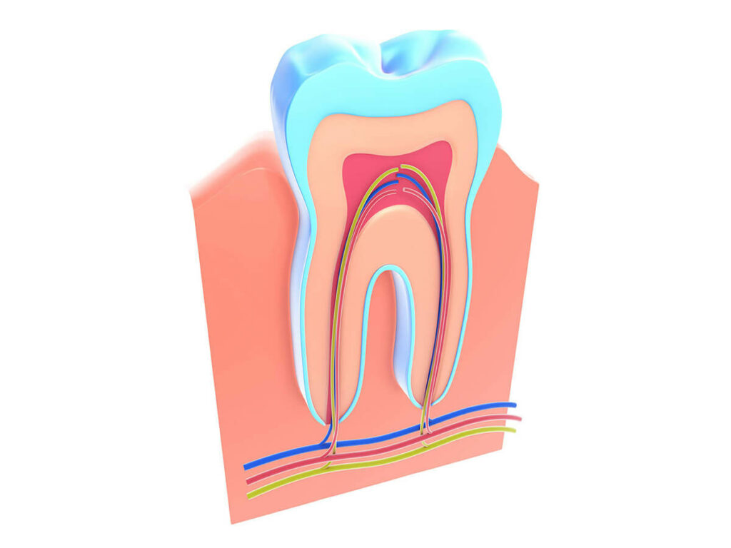 root canal